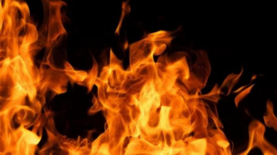 Man dies, wife injured in fire mishap