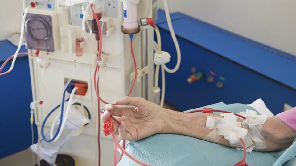 Government Hospitals to offer free dialysis to kidney ailment