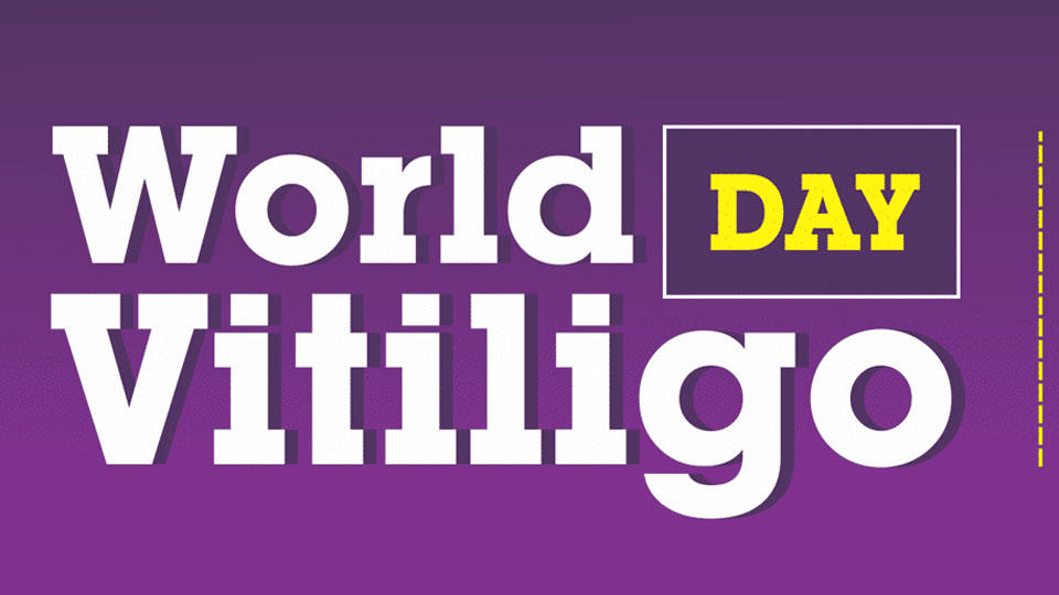 World Vitiligo Day observed
