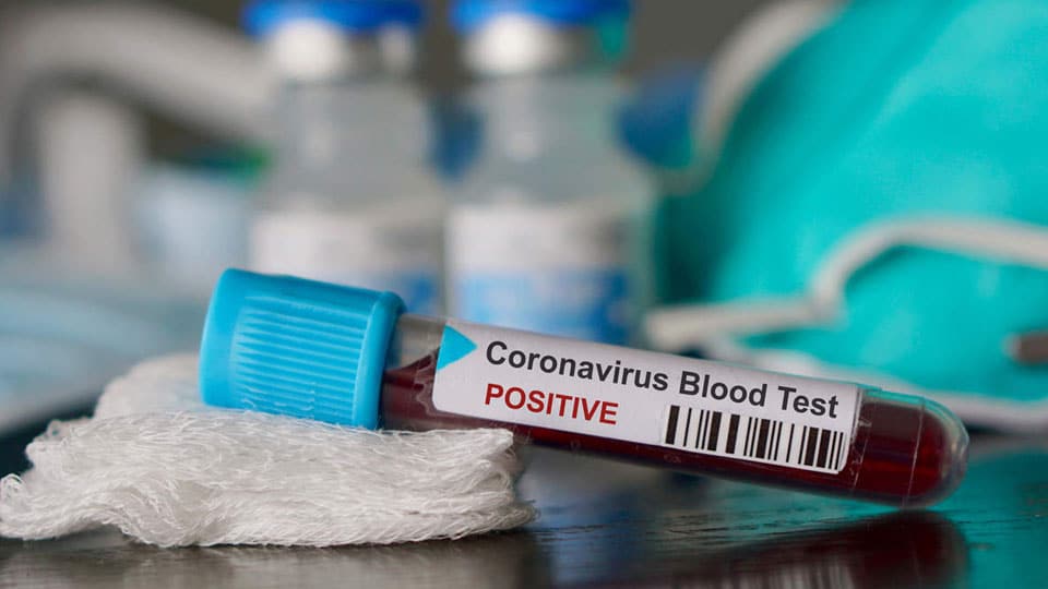 Three more test positive for COVID-19 in Mandya; one discharged from Mysuru