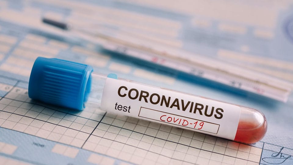 State Health Department warns Private Labs against commercial exploitation over Covid tests