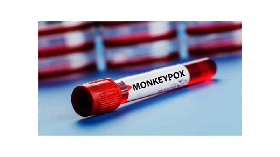 Suspected monkeypox case tests negative