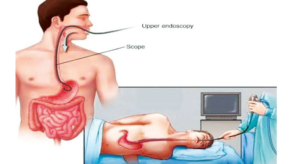 Endoscopy & Colonoscopy