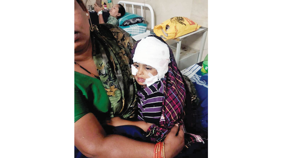 Girl child suffers deep bite wounds in stray dog attack