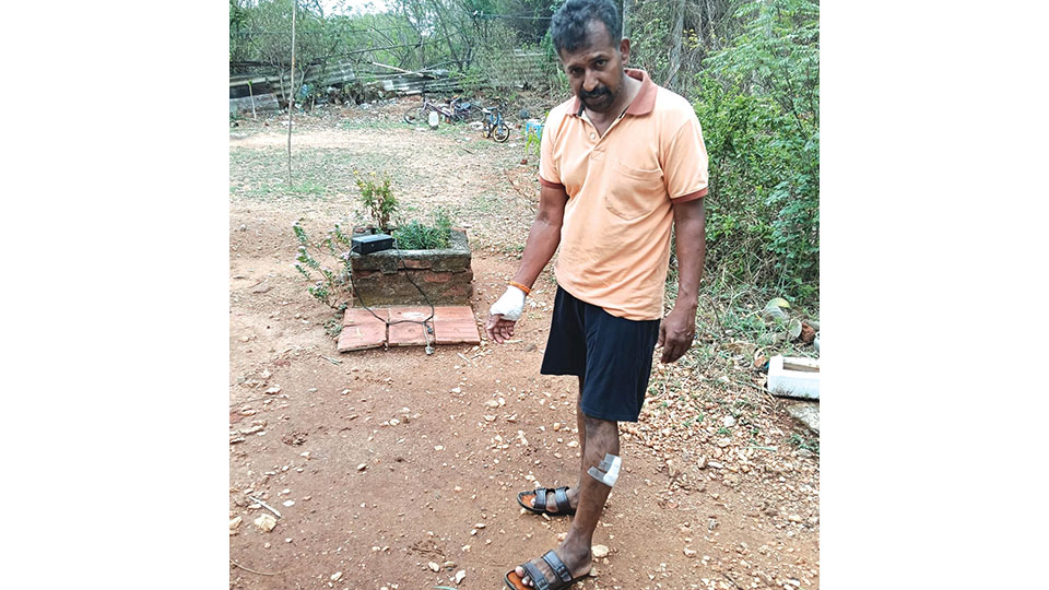 Stray dog attacks trigger fear at SBM Colony
